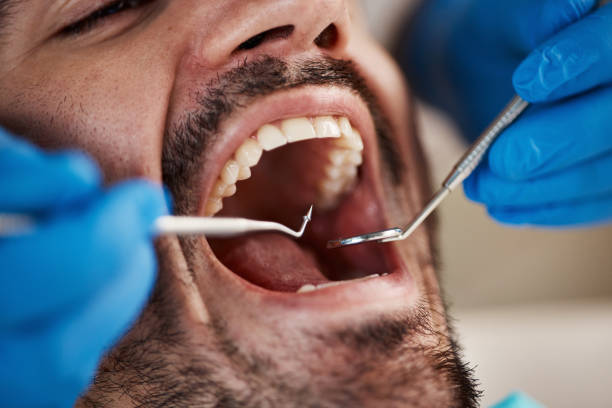 Best TMJ/TMD Treatment  in Ashville, OH